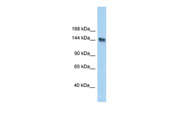 UACA Rabbit Polyclonal Antibody