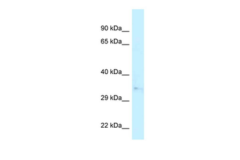 CAPZA2 Rabbit Polyclonal Antibody