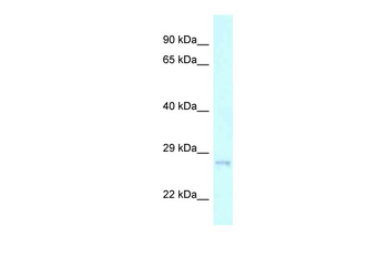 CHMP2A Rabbit Polyclonal Antibody