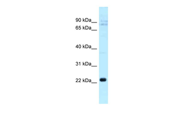 CLEC5A Rabbit Polyclonal Antibody