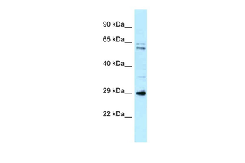 HSD17B8 Rabbit Polyclonal Antibody
