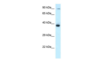 TAGAP Rabbit Polyclonal Antibody