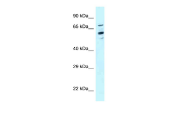 TOMM70 Rabbit Polyclonal Antibody