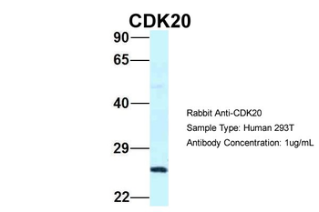 CDK20 Rabbit Polyclonal Antibody