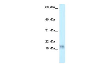 DNAL1 Rabbit Polyclonal Antibody
