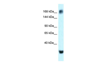 ATAD2 Rabbit Polyclonal Antibody