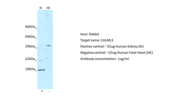 CALML3 Rabbit Polyclonal Antibody