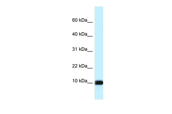 CALML3 Rabbit Polyclonal Antibody