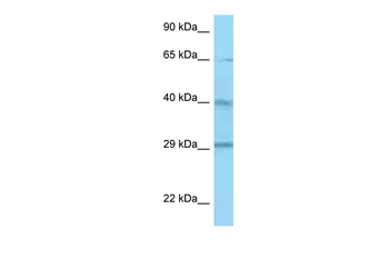CFHR1 Rabbit Polyclonal Antibody