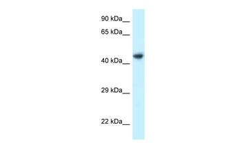 ILKAP Rabbit Polyclonal Antibody