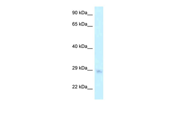 MTG1 Rabbit Polyclonal Antibody