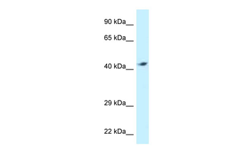 ATP6V1C2 Rabbit Polyclonal Antibody