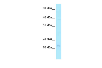 PFDN4 Rabbit Polyclonal Antibody
