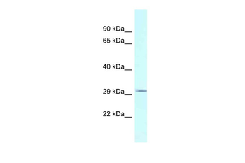 BSPRY Rabbit Polyclonal Antibody