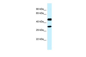 RDH13 Rabbit Polyclonal Antibody