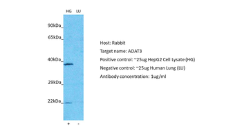 ADAT3 Rabbit Polyclonal Antibody