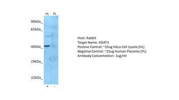 ADAT3 Rabbit Polyclonal Antibody