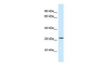C18orf1 Rabbit Polyclonal Antibody