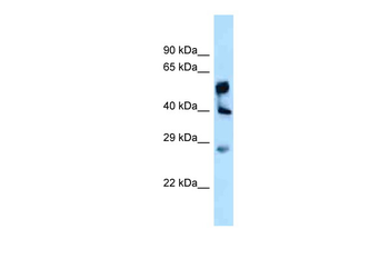 LPGAT1 Rabbit Polyclonal Antibody