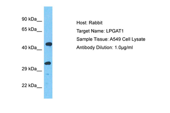 LPGAT1 Rabbit Polyclonal Antibody