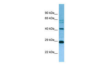 MRPL38 Rabbit Polyclonal Antibody