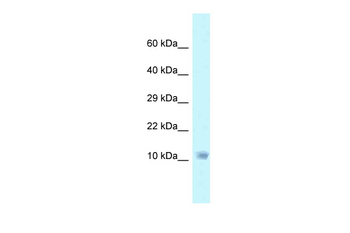 NDUFA6 Rabbit Polyclonal Antibody