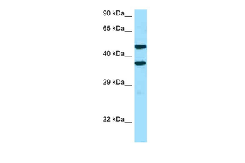 SFXN2 Rabbit Polyclonal Antibody