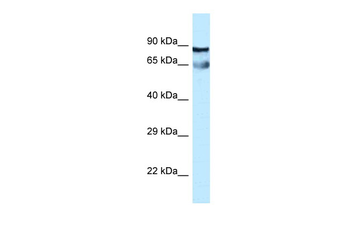 CEP76 Rabbit Polyclonal Antibody