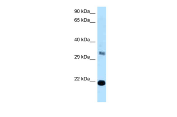 FKBP14 Rabbit Polyclonal Antibody