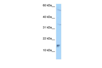 MAGOHB Rabbit Polyclonal Antibody