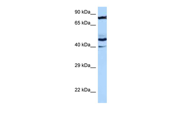 MRPS31 Rabbit Polyclonal Antibody