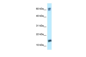 NUDT2 Rabbit Polyclonal Antibody
