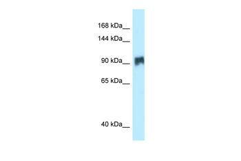 SIK2 Rabbit Polyclonal Antibody