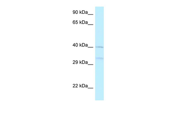 AZI2 Rabbit Polyclonal Antibody