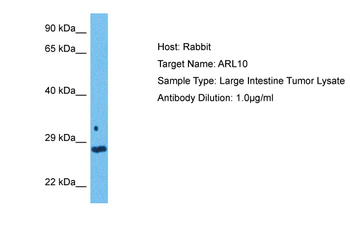ARL10 Rabbit Polyclonal Antibody