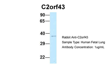 LDAH Rabbit Polyclonal Antibody