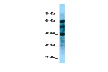 FBXL8 Rabbit Polyclonal Antibody