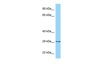 GPN3 Rabbit Polyclonal Antibody