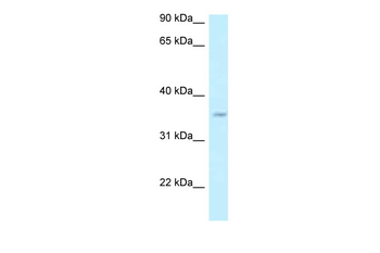 GPN3 Rabbit Polyclonal Antibody