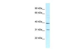 MRPL46 Rabbit Polyclonal Antibody