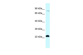 RPS6KA4 Rabbit Polyclonal Antibody