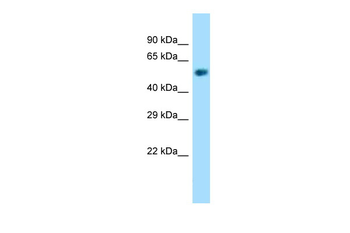NAPRT Rabbit Polyclonal Antibody