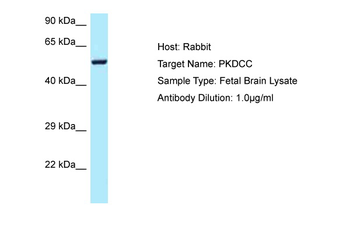 PKDCC Rabbit Polyclonal Antibody