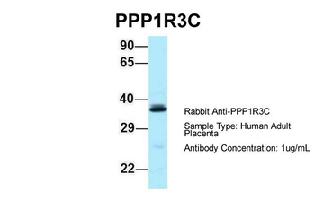 PPP1R3C Rabbit Polyclonal Antibody