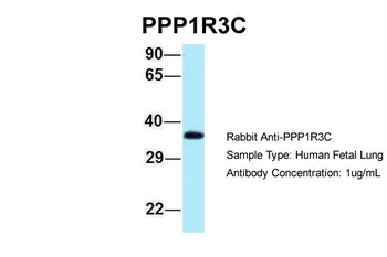 PPP1R3C Rabbit Polyclonal Antibody