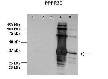 PPP1R3C Rabbit Polyclonal Antibody