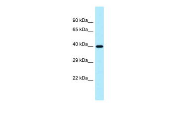 PPP1R3C Rabbit Polyclonal Antibody