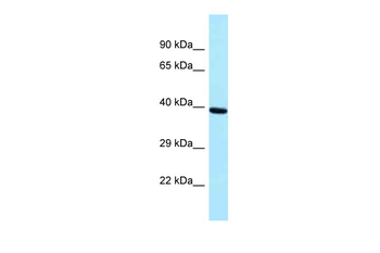 PRPF18 Rabbit Polyclonal Antibody