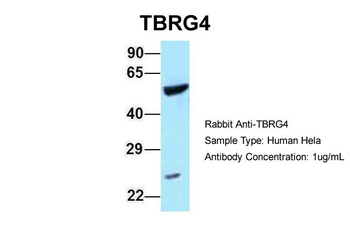 TBRG4 Rabbit Polyclonal Antibody