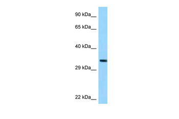 TRUB1 Rabbit Polyclonal Antibody